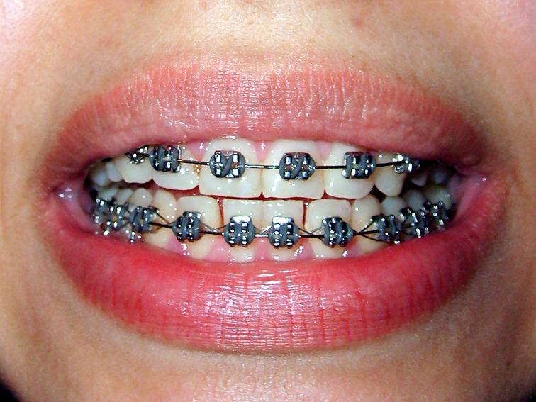 Czym jest ortodoncja